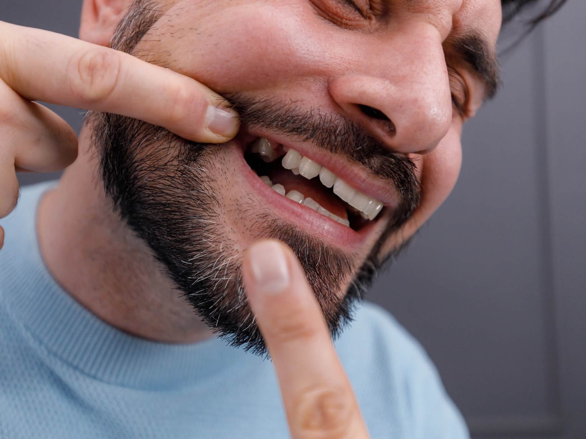 Eksik Dişlere En Uygun Tedavi Hangisi?