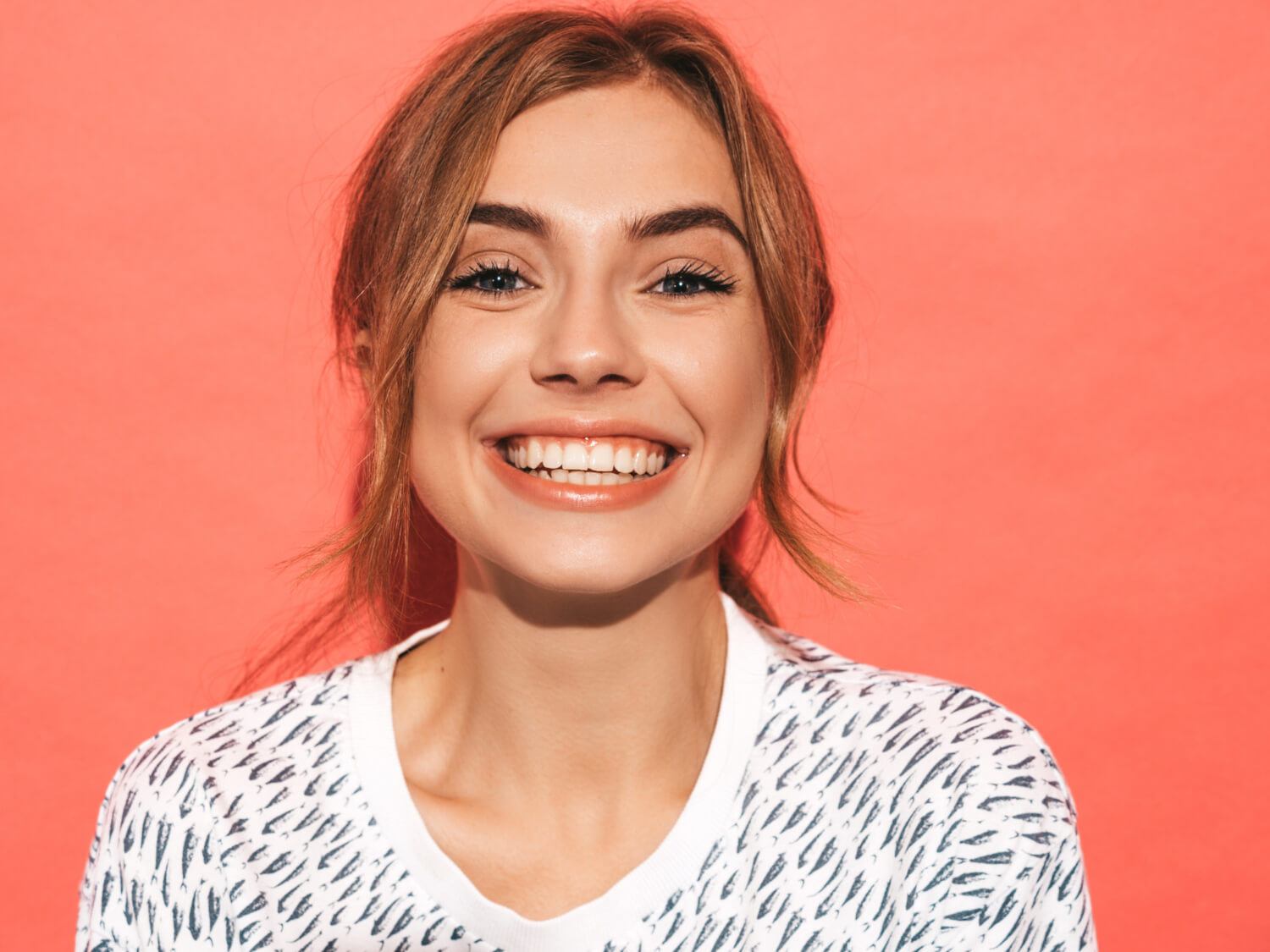 Hollywood Smile Nedir, Nasıl Yapılır?